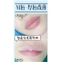 天丽卡婕宁整形 