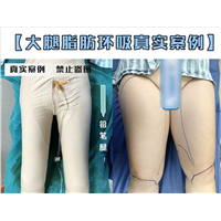 重庆整形医院推荐 