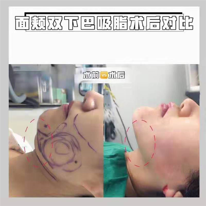 重庆整形医院推荐 