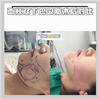 重庆整形医院推荐 