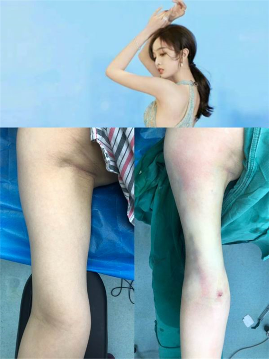 重庆整形医院推荐 
