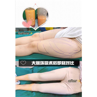 重庆整形医院推荐 