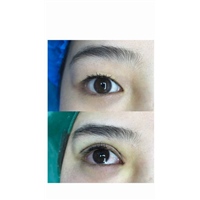 重庆眼综合修复
