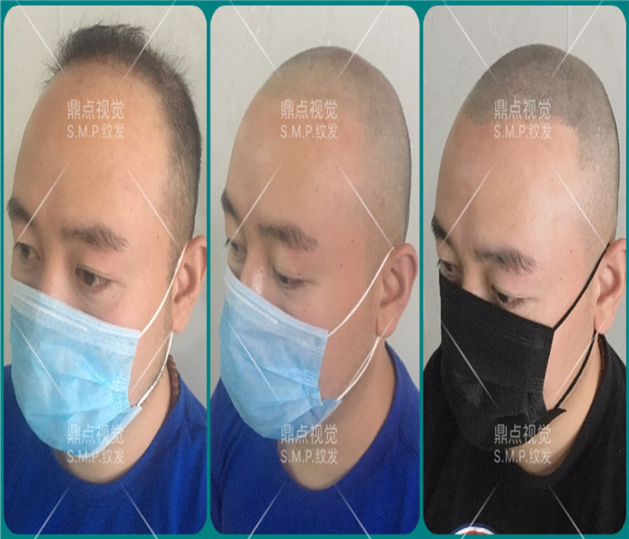 西安纹发效果图 