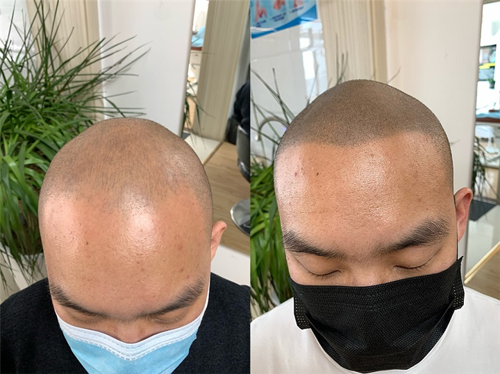 西安纹发机构