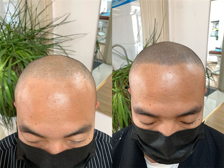 西安纹发机构