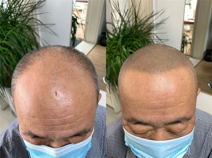 西安纹发 ，纹发案例