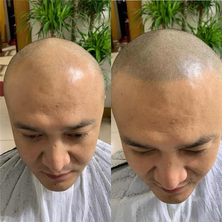 西安纹发