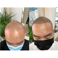 西安纹发机构