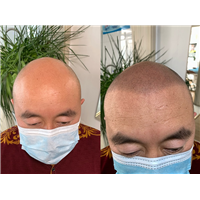西安纹发