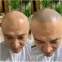 西安纹发到底是怎么纹的纹发具体操作流程