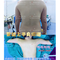 郑州0血水吸脂