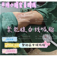 郑州人鱼马甲线吸脂