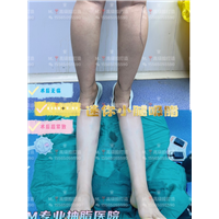 郑州0血水吸脂