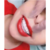 武汉全瓷贴面培训