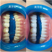武汉美牙培训