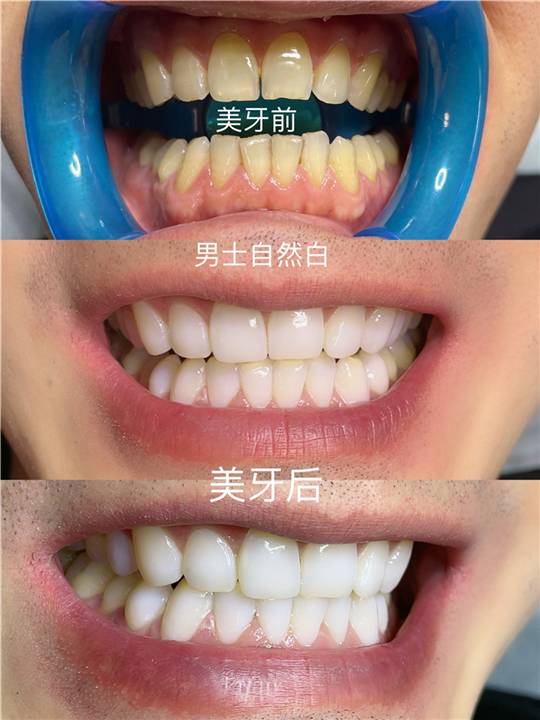 武汉纳米美牙