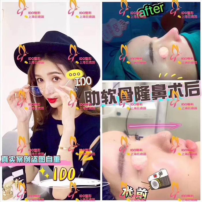 沪上网红整形|沪上专业网红整形