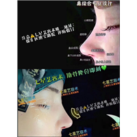 上海肋骨鼻综合 