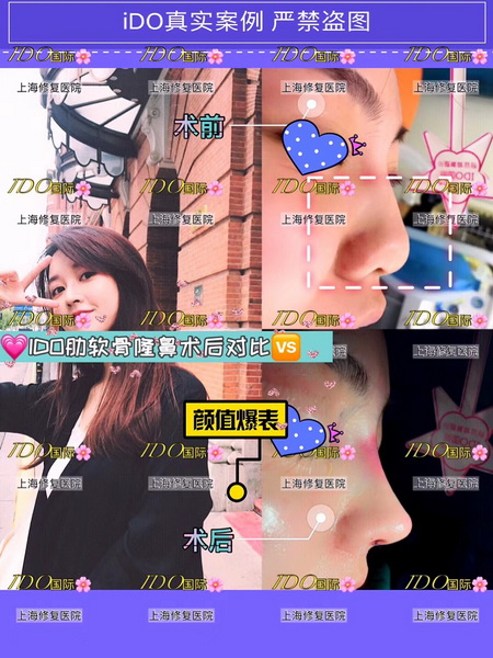 ido整形怎么样|上海整形修复医院