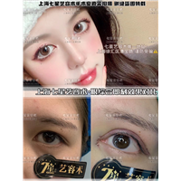 上海眼综合整形多少钱 