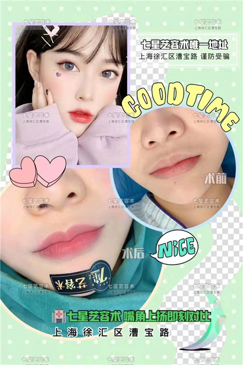 上海七星艺容术微笑M唇 