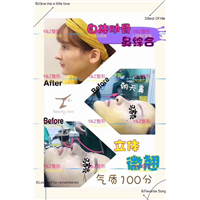 上海IDO整形隆鼻方法 