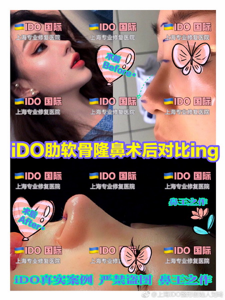 ido整形怎么样|上海整形修复医院