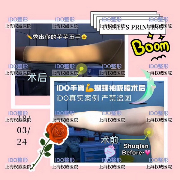 上海ido整形修复医院|上海ido鼻整形