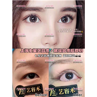 上海眼综合整形 