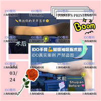 上海ido整形修复医院|上海ido鼻整形