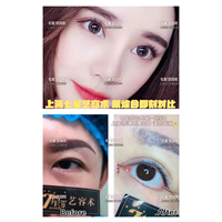 上海眼综合整形哪家好 