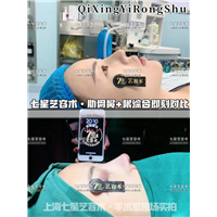 上海鼻整形医院 