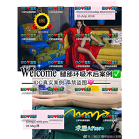 上海ido整形修复医院|上海ido鼻整形
