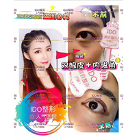 上海眼综合 