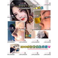 ido整形怎么样|上海整形修复医院