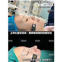上海隆鼻整形医院哪家好 