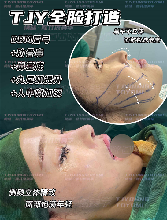 郑孔平-眉骨肋骨鼻鼻基底九尾狐精灵耳人中窝3