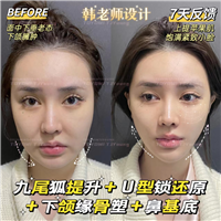 罗子琁-九尾狐+U型锁+鼻基底 (3)