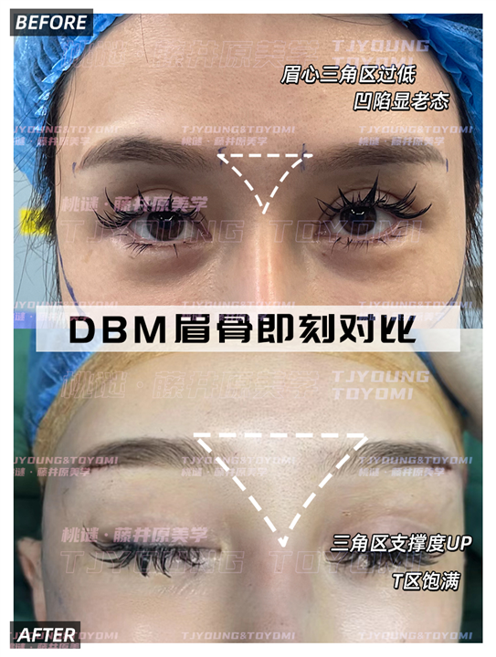 郑孔平-眉骨肋骨鼻鼻基底九尾狐精灵耳人中窝4