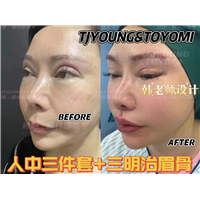 宋平平-人中三件套3