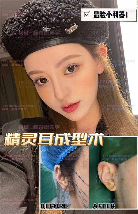 郑孔平-眉骨肋骨鼻鼻基底九尾狐精灵耳人中窝