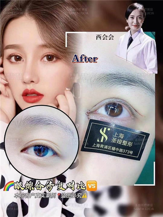 上海圣娅整形