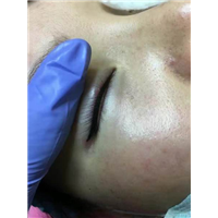 深圳纹眼线多少钱 