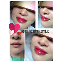 深圳半**嘴唇 