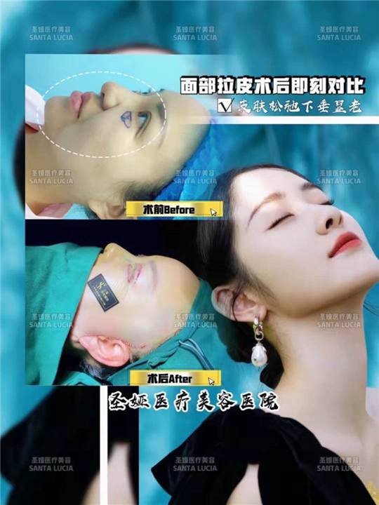 上海圣娅美容整形医院