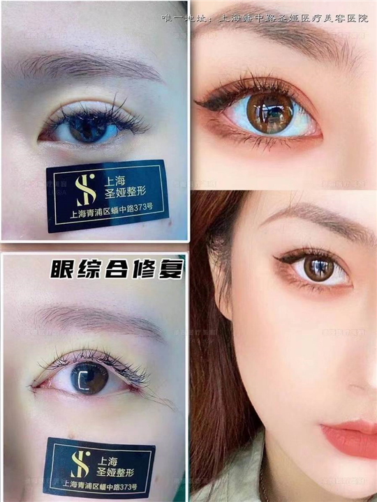 上海圣娅整形