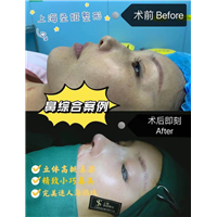 上海圣娅整形医院电话