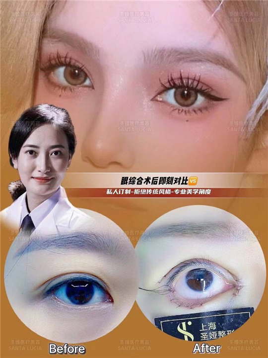 上海圣娅整形
