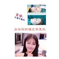 重庆人气网红整形|重庆鼻综合整形